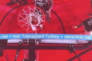 问啥詹姆斯!NBA篮板上沿有土耳其植发公司广告 手动@杰伦-布朗